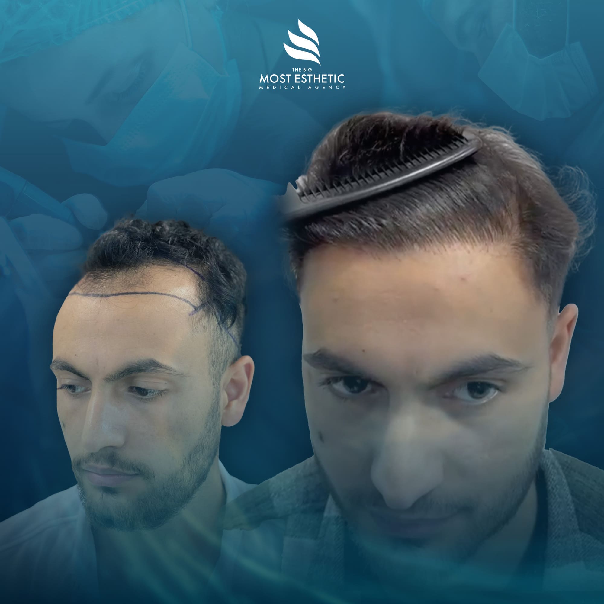 Professional Hair Transformation