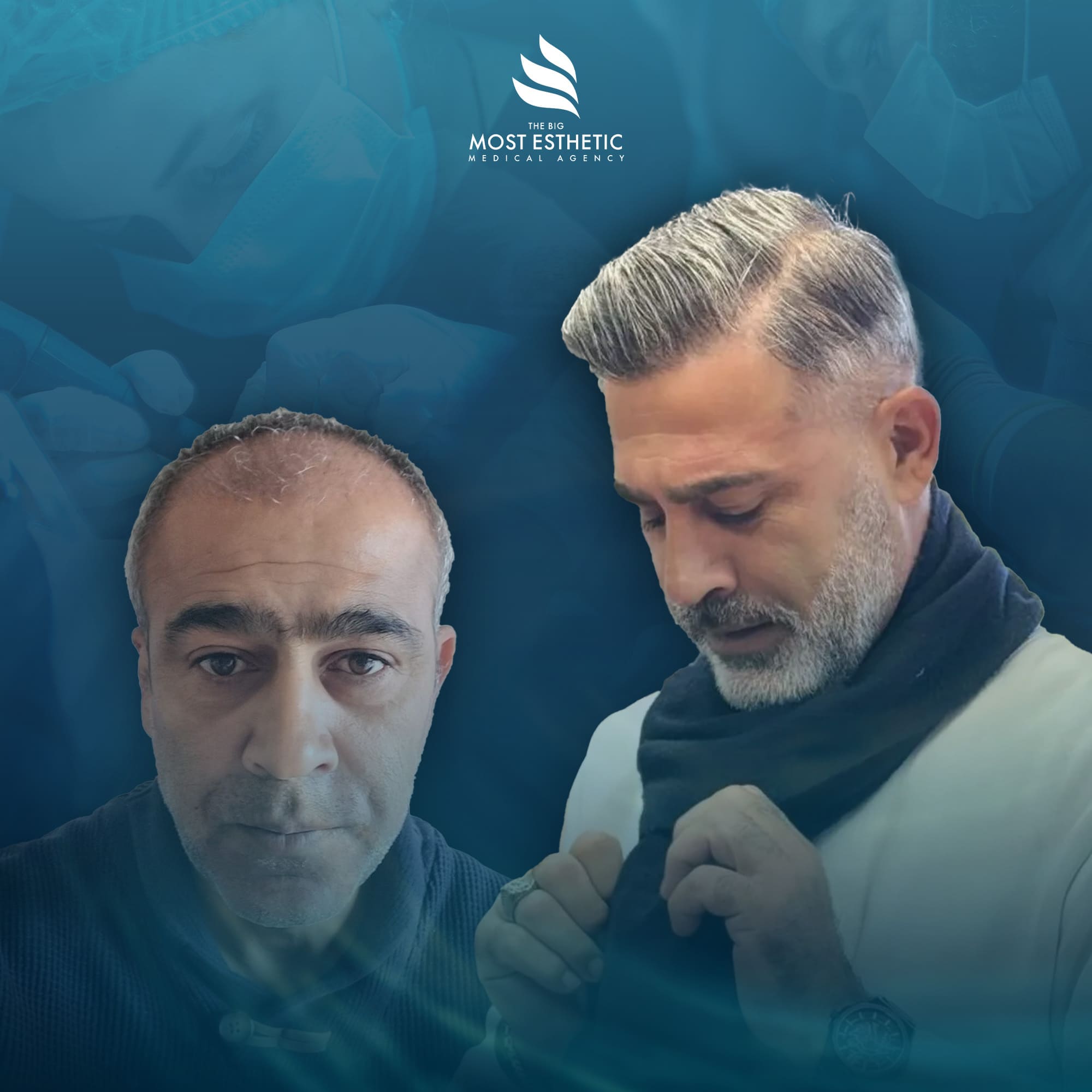 Premium Hair Transformation